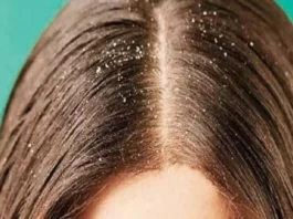Hair Care Tips