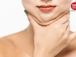 face fat