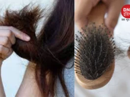 hairfall problem