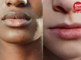 how to brighten dark lips