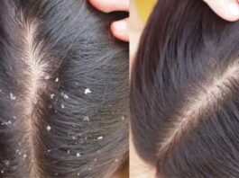 Hair Care Tips