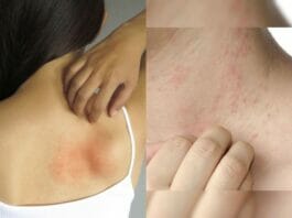 Skin Tips