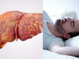 Sleep Related Disorders at Night