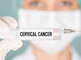 Cervical Cancer