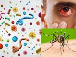 Infectious Disease