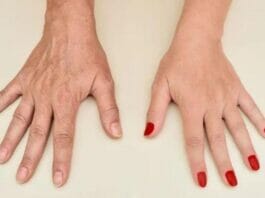 Hand Wrinkles: