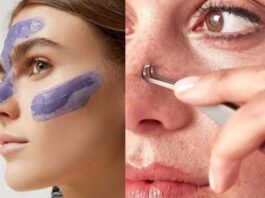 Black Heads Removal