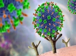 nipah virus