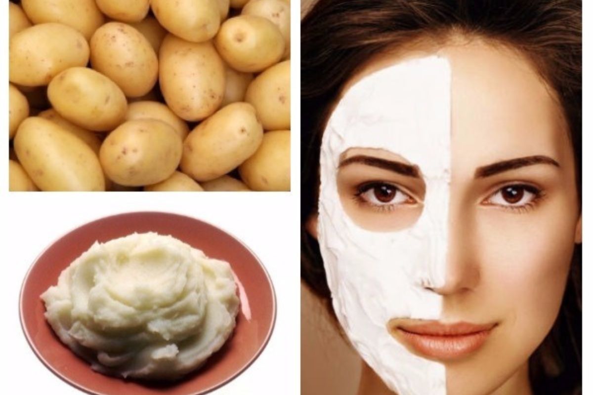 Potato Use For Skin झुर्रियां, दाग धब्बों से हैं परेशान
