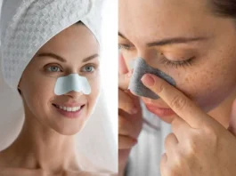 Blackheads Removal Tips: