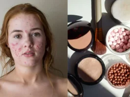 Skin Care Tips: