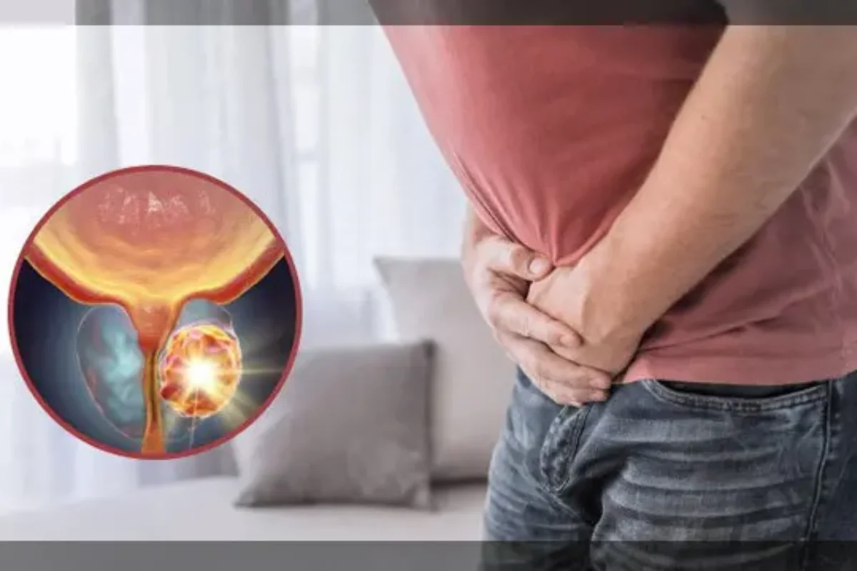Prostate Cancer