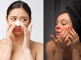 Skincare Tips