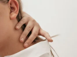 Cervical Spondylosis