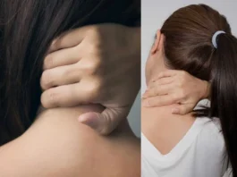 Cervical Spondylosis