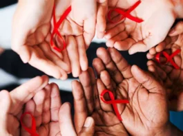 HIV-AIDS