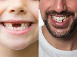 Human Teeth