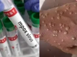 MPOX