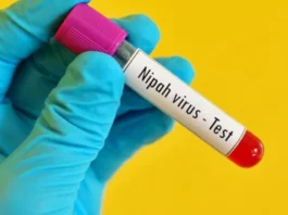 Nipah Virus