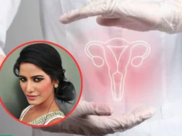 Cervical Cancer