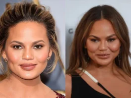 Chrissy Teigen