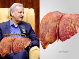 Fatty Liver