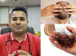 Hair Loss
