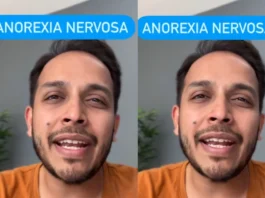 Anorexia Nervosa