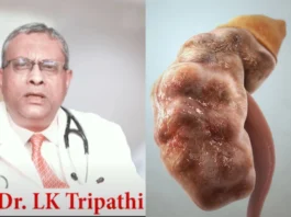Chronic Kidney Disease
