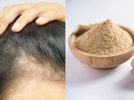 Bald Patches