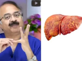 Fatty Liver