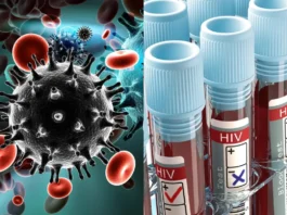 Uttarakhand HIV Cases