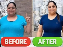 Weight Loss