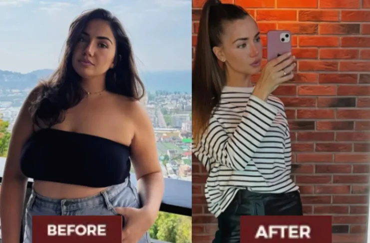 Weight Loss
