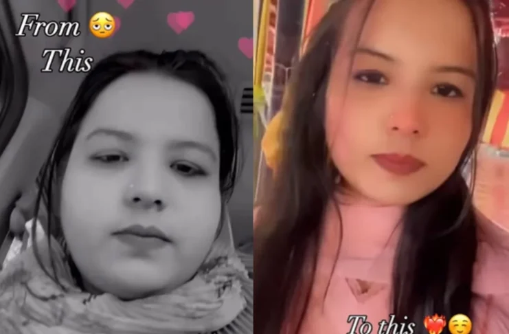 Weight Loss