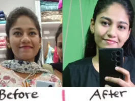 Weight Loss