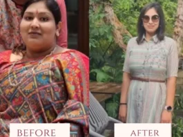 Weight Loss