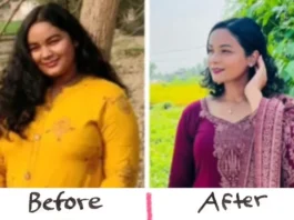 Weight Loss