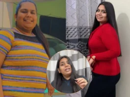 Weight Loss