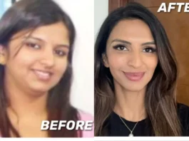 Weight Loss