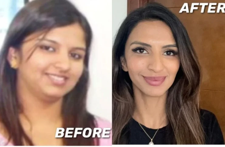 Weight Loss