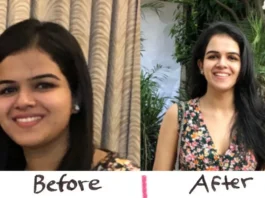 Weight Loss