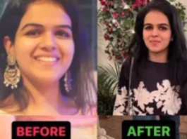 Weight Loss