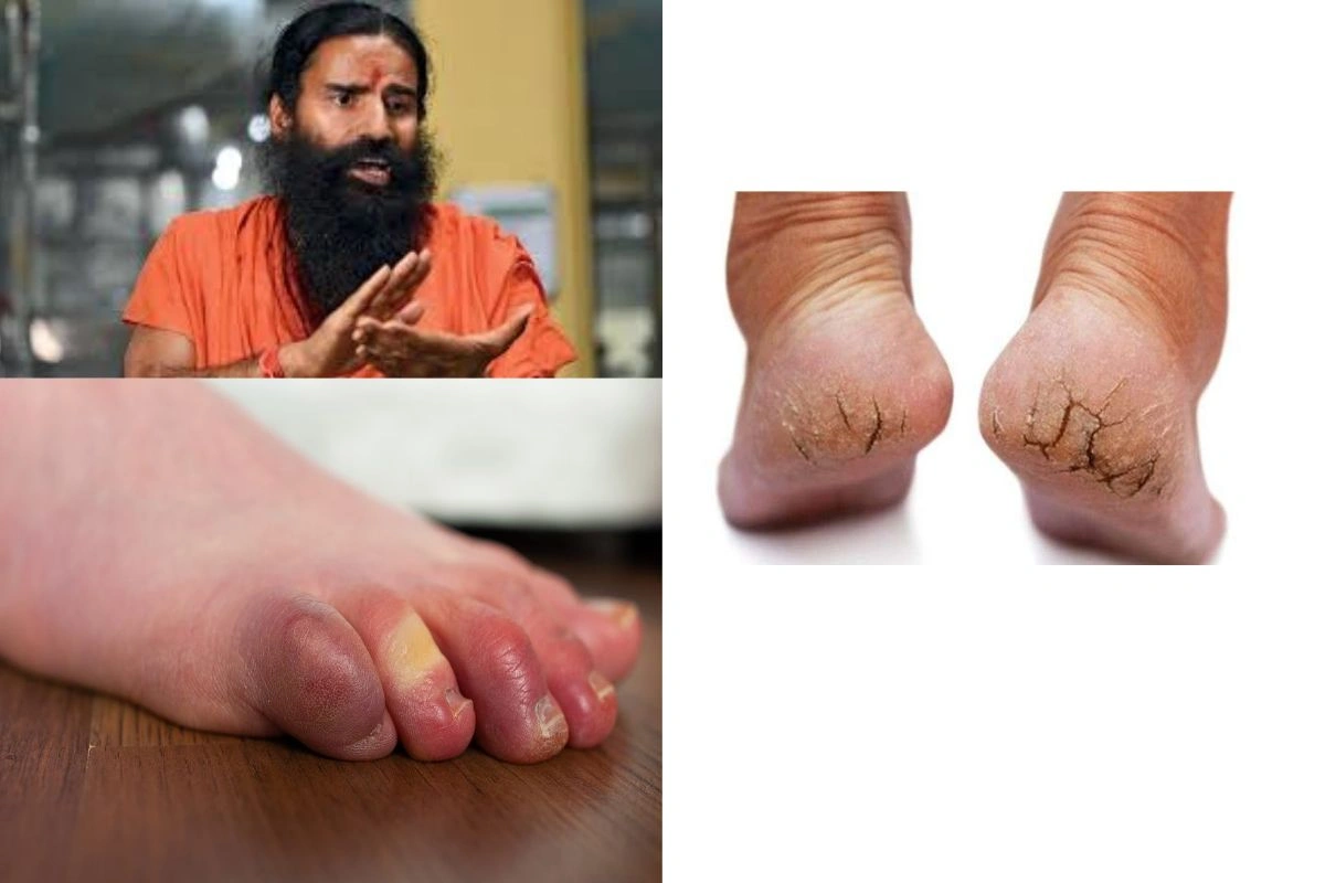 Baba Ramdev Video Baba Ramdev Video