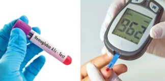 Blood Sugar: डायबिटीज के मरीज को महीने में कितनी बार करवाना चाहिए टेस्ट ? जानें क्यों HbA1c परीक्षण भी है अनिवार्य Blood Sugar
