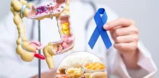 Colorectal Cancer: जमकर खा रहे अल्ट्रा-प्रोसेस्ड फूड्स तो हो जाएं अलर्ट, 20 के बाद इस कैंसर के घेरे में आ रहे छोटे उम्र के लोग, जानें कैसे बचें Colorectal Cancer