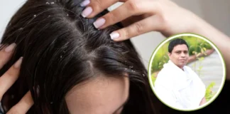 Dandruff Home Remedies: सर्दियों में डैंड्रफ का सिरदर्द खत्म! हफ्ते में 2 बार आजमाएं ये 2 नुस्खे, आयुर्वेद के एक्सपर्ट ने बताया बाल भी होंगे मजबूत Dandruff Home Remedies