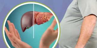 Fatty Liver का क्या हो सकता है अंत, कहीं आप तो नहीं डेंजर जोन को कर रहे पार, फटाफट जानें खतरनाक लक्षण Fatty Liver