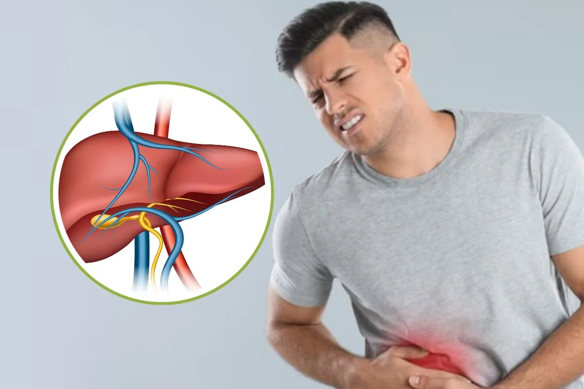 Fatty Liver Fatty Liver