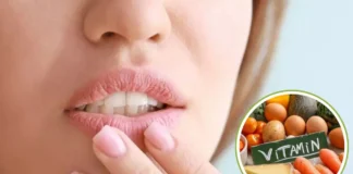 सर्दी में होंठ फटने की वजह है इस विटामिन की कमी, डॉक्टर ने किया इन खास लोगों को अलर्ट Vitamin B2